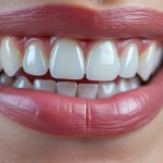 découvrez les risques et précautions liés aux couronnes métalliques avant de vous faire poser une couronne dentaire. informez-vous pour un choix éclairé et sécurisé.