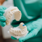 Les conséquences d’un traitement orthodontique mal suivi sur la santé bucco dentaire
